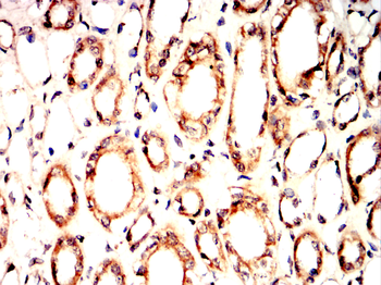 ABCG1 Antibody