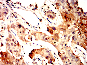 ABCG1 Antibody