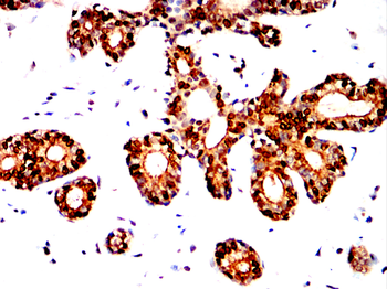 FOXA1 Antibody