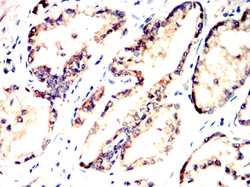 FOXA1 Antibody