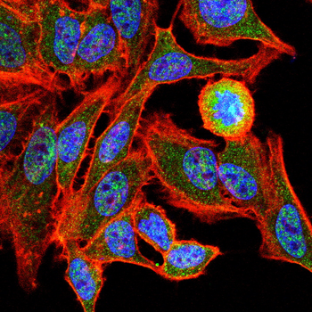 ATF6 Antibody