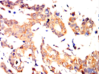 ATF6 Antibody
