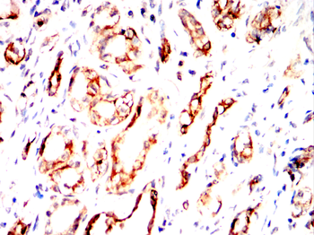 ATF6 Antibody