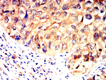 ATF6 Antibody