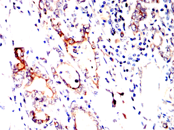 ATF6 Antibody