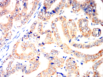ATF6 Antibody