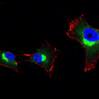 ATF4 Antibody