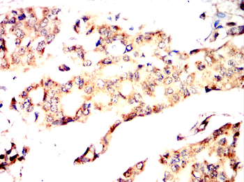 ATF4 Antibody