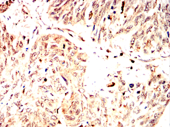 ATF4 Antibody