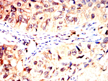 ATF4 Antibody