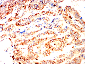 ATF4 Antibody