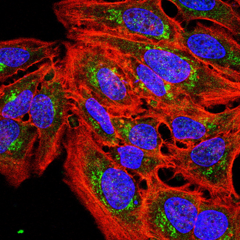 PTEN Antibody