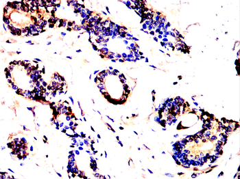 PTEN Antibody