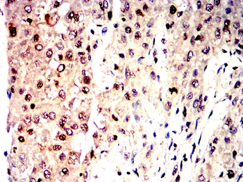 PTEN Antibody