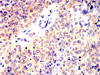 PTEN Antibody