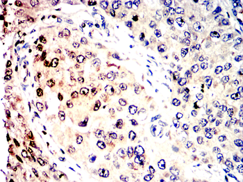 PTEN Antibody