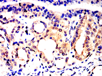 PTEN Antibody