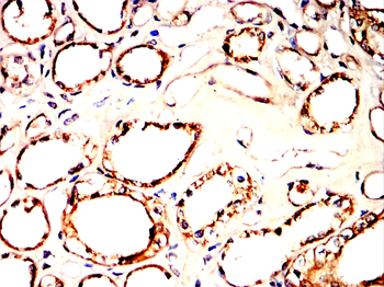 VEGFA Antibody