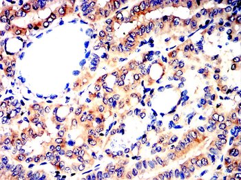 VEGFA Antibody