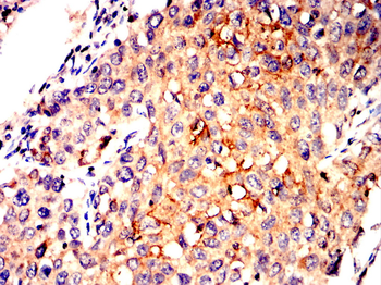 SLC2A1 Antibody