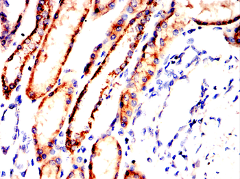 SLC2A1 Antibody