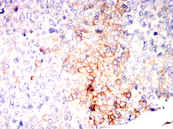 SLC2A1 Antibody
