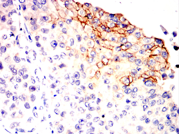 SLC2A1 Antibody