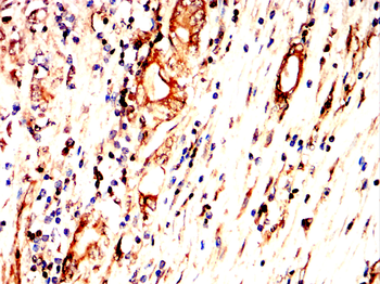 LYVE1 Antibody