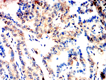 LYVE1 Antibody