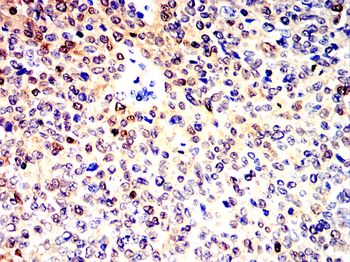 S100A4 Antibody