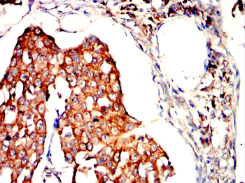MERTK Antibody