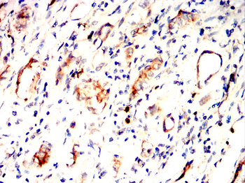 MERTK Antibody