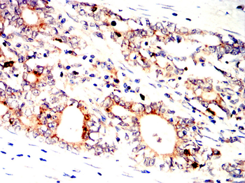 MERTK Antibody
