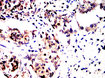 TXNIP Antibody