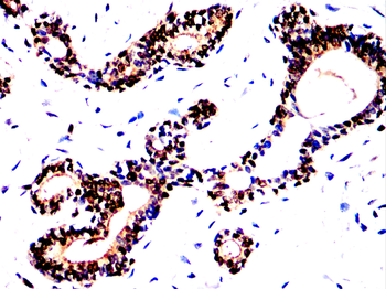 TXNIP Antibody