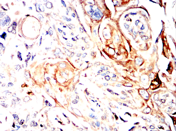 TXNIP Antibody