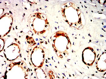 TXNIP Antibody