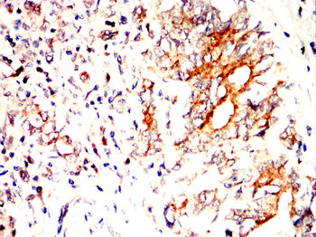 AIFM1 Antibody