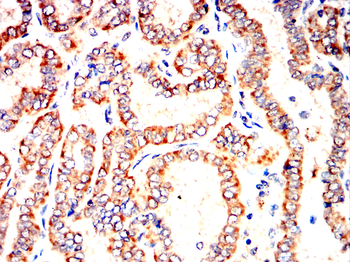 AIFM1 Antibody