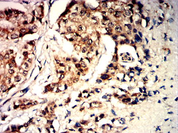 IRAK4 Antibody