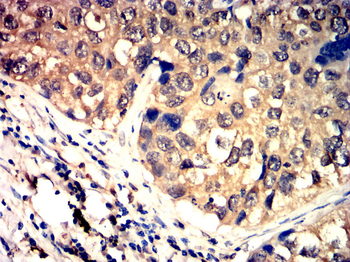 IRAK4 Antibody