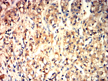 IRAK4 Antibody