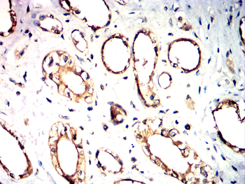 IRAK4 Antibody