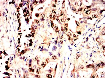 GSTP1 Antibody