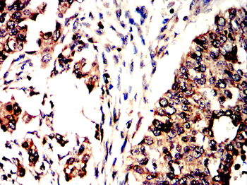 CCNE1 Antibody