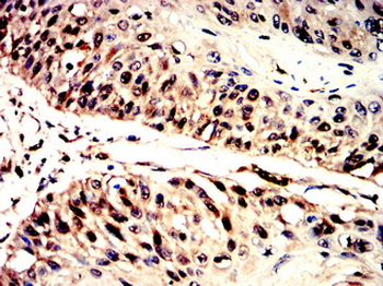CCNE1 Antibody