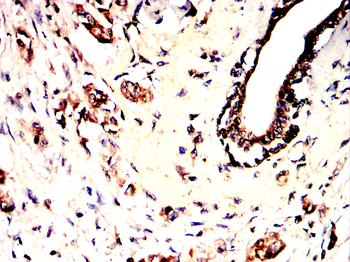 CD27 Antibody