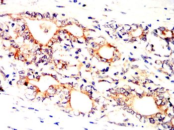 CD27 Antibody