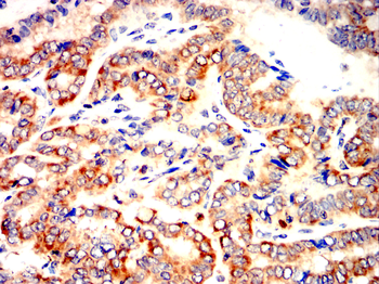 CD27 Antibody
