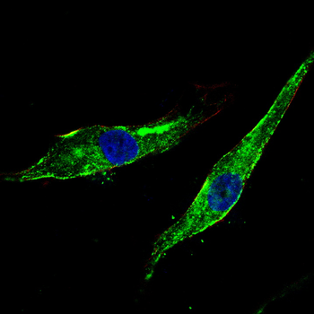 CD36 Antibody